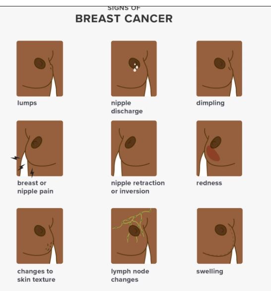 Breast Cancer Signs. Net Photo.